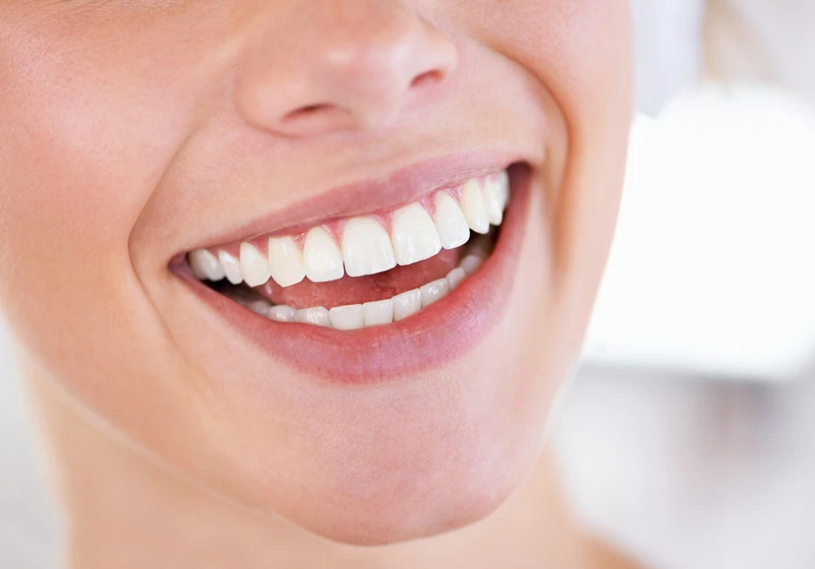 Estética dental blanqueamiento | Clínica Dental Silvia Utrilla Estética dental blanqueamiento | Clínica Dental Silvia Utrilla